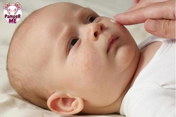 Các bệnh lý thường gặp ở trẻ sơ sinh